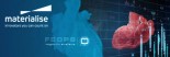 Materialise收购比利时公司FEops，加码结构性心脏病领域